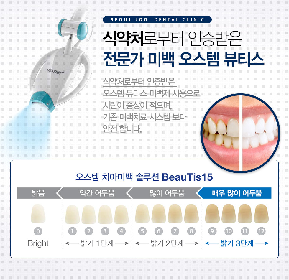 네비게이션 수술 / 오스템 원가이드 수술 컴퓨터로 완성하는 과학적인 임플란트