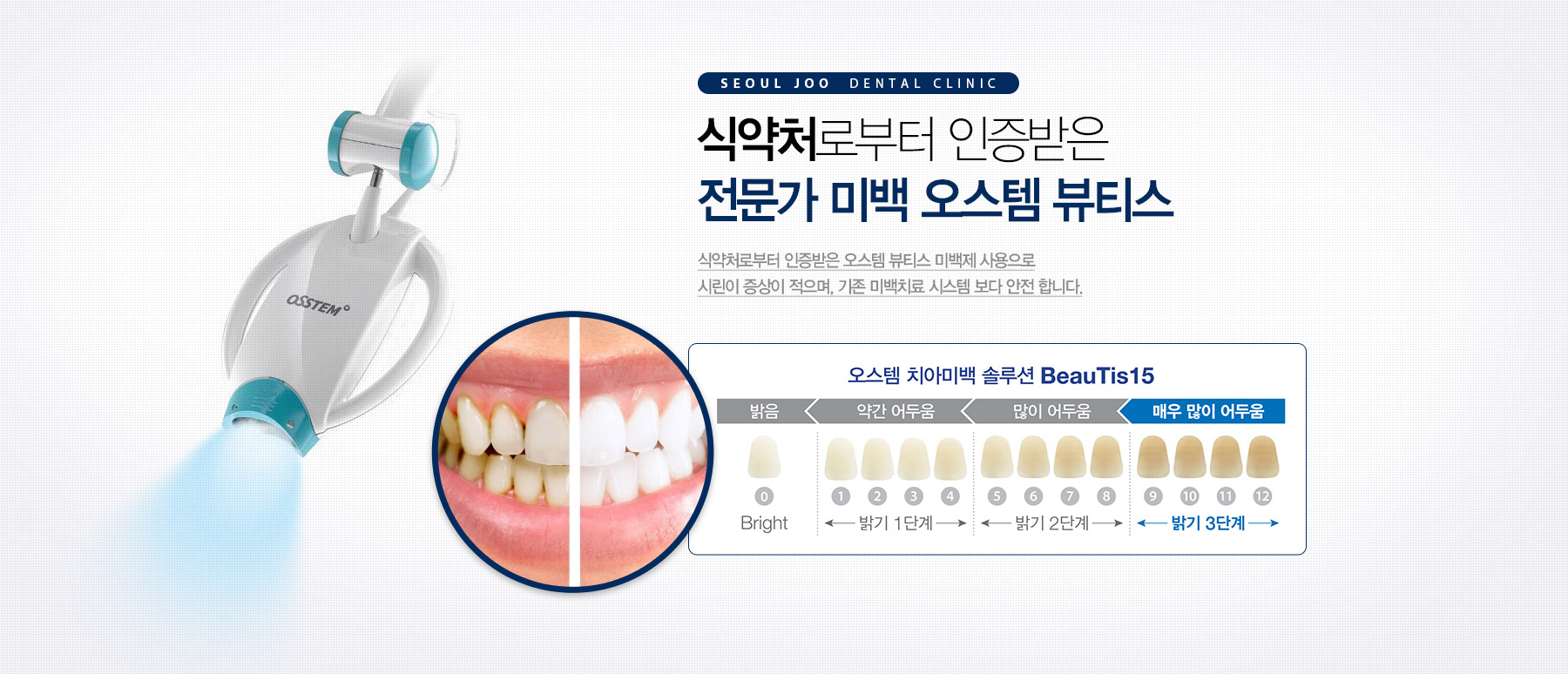 네비게이션 수술 / 오스템 원가이드 수술 컴퓨터로 완성하는 과학적인 임플란트